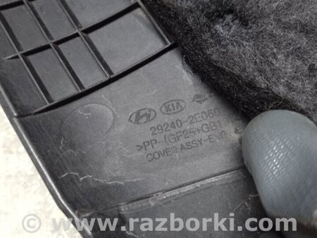 ФОТО Накладка двигуна декоративна для Hyundai Elantra VI AD (15-20) Київ