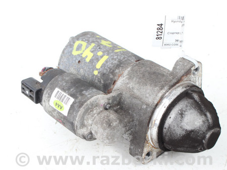ФОТО Электрика моторной группы для Hyundai i40 VF (11-21) Київ